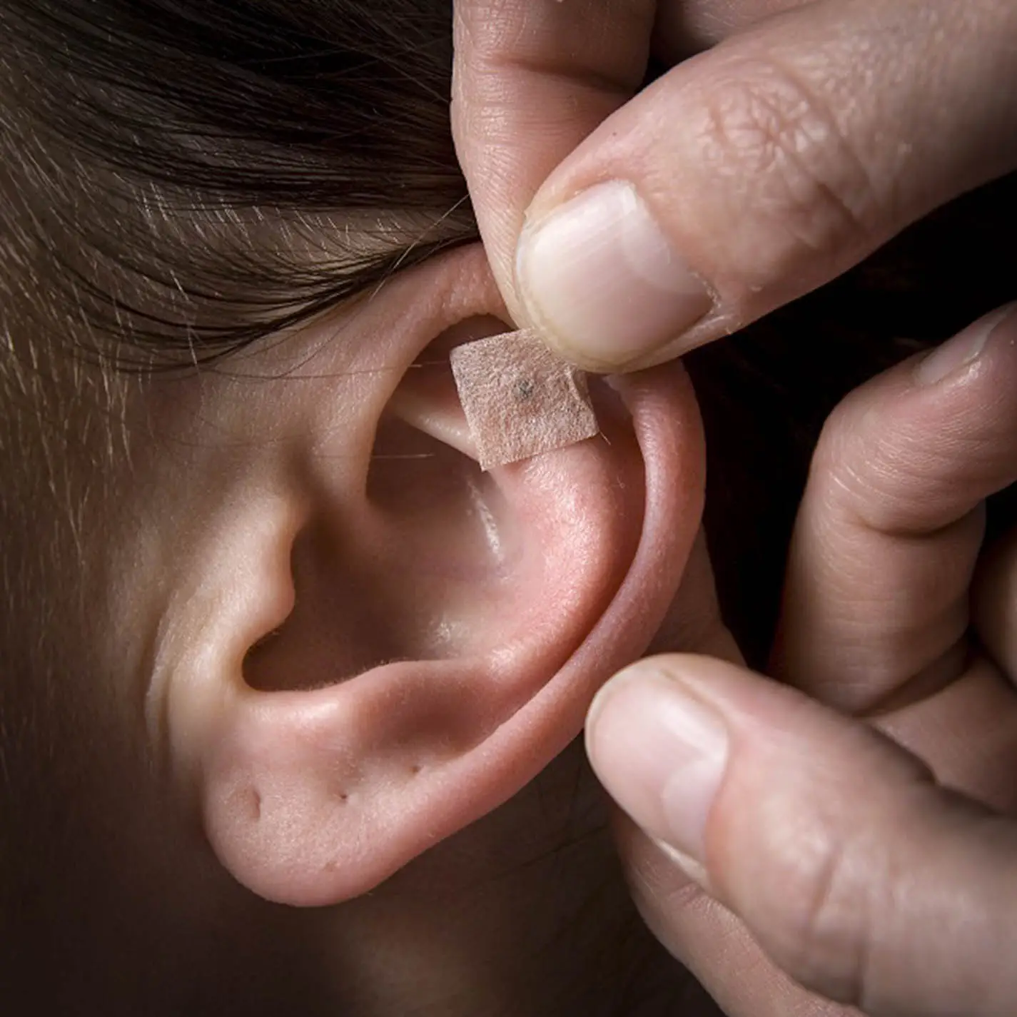 Praticien appliquant un point d'auriculothérapie sur l'oreille d'une personne. Intuici, Médecine Traditionnelle Chinoise, Genève.