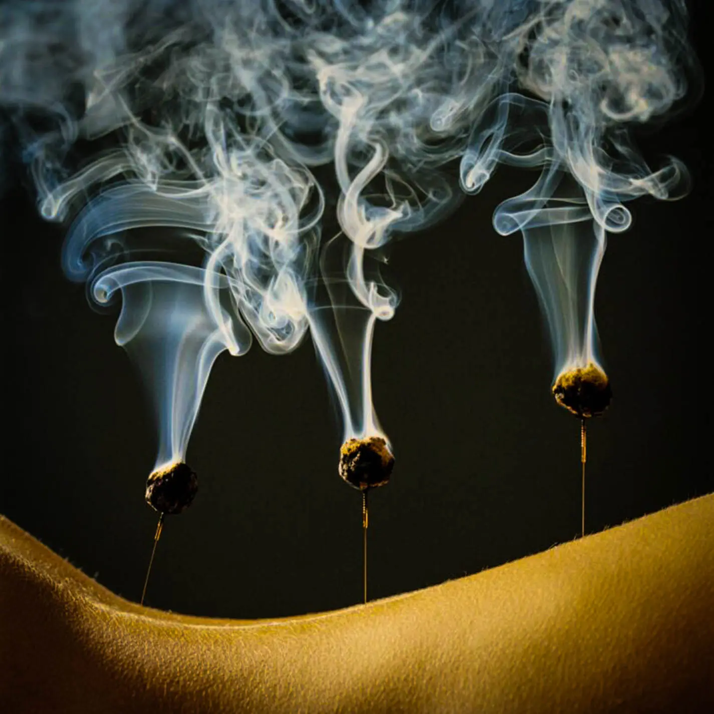 Moxibustion sur aiguilles d'acupuncture. Intuici, Médecine Traditionnelle Chinoise, Genève.